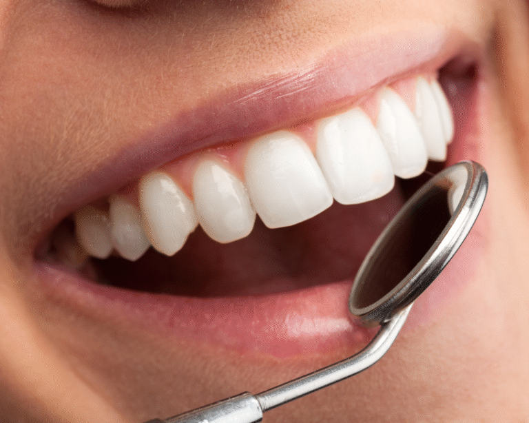 Close-up of a smile with straight white teeth and a dental mirror