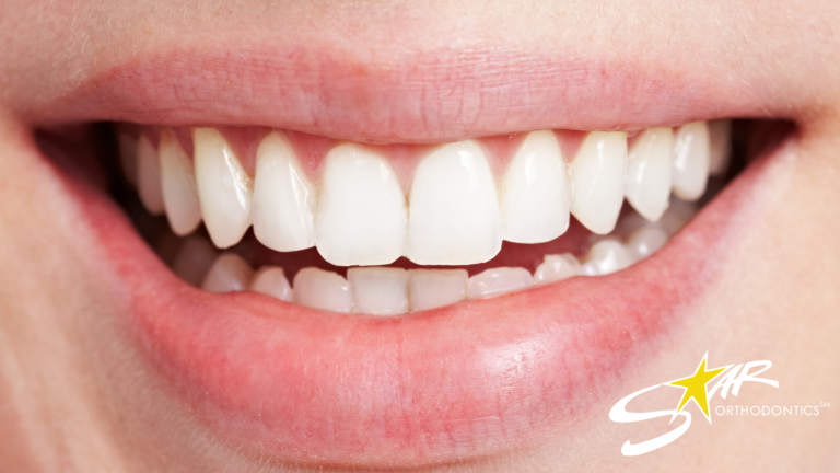 Close-up of a bright white smile with straight teeth