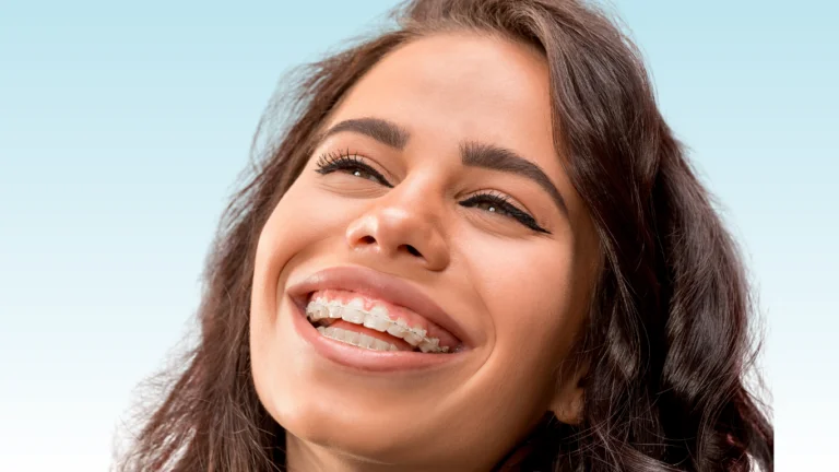 Smiling young woman wearing clear ceramic braces on her upper teeth