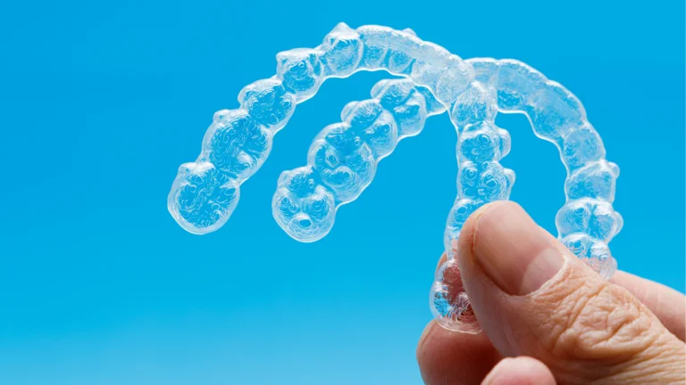 Hand holding clear plastic aligner trays against a blue background