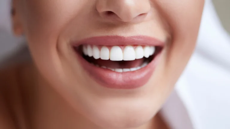 Close-up of a woman smiling with straight white teeth