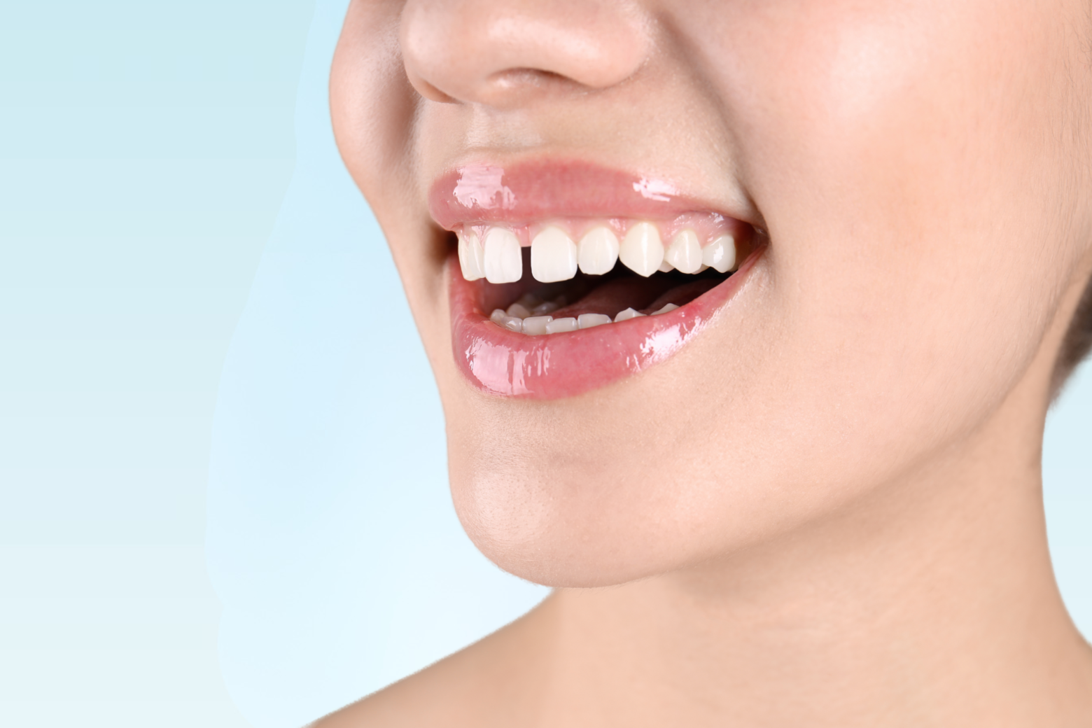 Close-up of a smiling woman's mouth and upper teeth against a light blue background