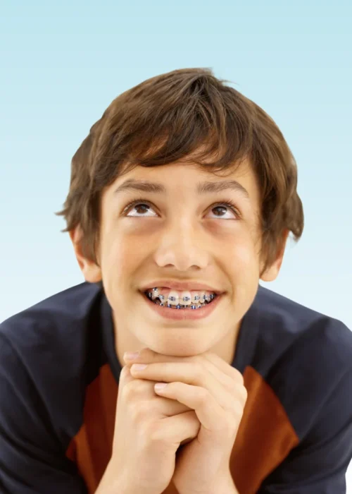 Smiling boy with blue and silver braces resting his chin on his hands, looking upward